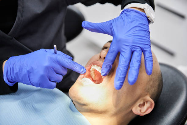 Best Emergency Dental Care for Sports Injuries in Southern View, IL